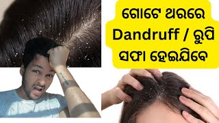 ଶୀତଦିନେ Dandruff/ ରୁପି ସମସ୍ୟାର ଚୁଟକିରେ ସମାଧାନ କରନ୍ତୁ ॥ Homeremedies for Dandruff #sanjeevdiary