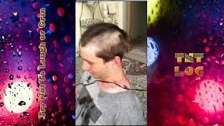 Funny Hairline Fails - Messed Up Hairlines Funny Compilation 2016