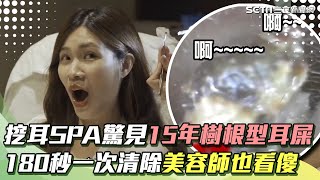 慎入！180秒「挖耳SPA」累積15年樹根型耳屎一次清除 美容師也驚呼：好像鼻涕！！｜祝你健康