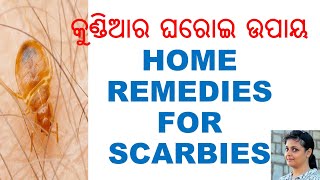 କୁଣ୍ଡିଆର ଘରୋଇ ଉପାୟ,ODIA,ODIA HEALTH TIPS,ODIA HOME REMEDIES,CURE SCRABIES NATURALLY,VARKHA MOHAPATRA