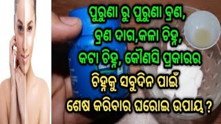 ପୁରୁଣା ରୁ ପୁରୁଣା ବ୍ରଣ,ବ୍ରଣ ଦାଗ,କଳା ଚିହ୍ନ ଏବଂ କୌଣସି ପ୍ରକାରର ଚିହ୍ନକୁ ସବୁଦିନ ପାଇଁ ଶେଷ କରିବାର ଘରୋଇ ଉପାୟ?