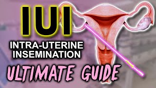 IUI - Fertility expert secrets for maximum pregnancy rates