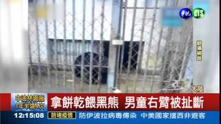 伸手餵黑熊 男童右臂被扯斷