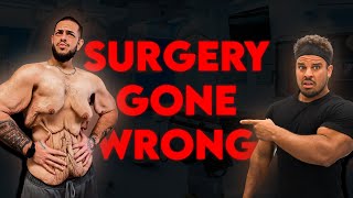 This Surgery Does NOT Look Safe...