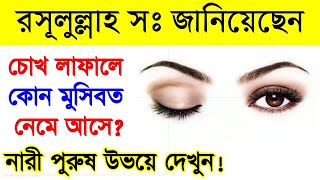 রাসুলুল্লাহ সাঃ জানিয়েছেন চোখ লাফালে কোন মুসিবত নেমে আসে┇বিড়াল রাস্তা কাটলে কি হয়┇Islamic Knowledge