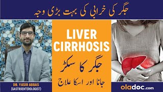 Liver Cirrhosis Symptoms Treatment - Jigar Ka Sukarna - Jigar Kharab Hone Ki Alamat - Liver Problems