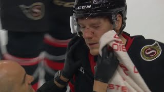 Parker Kelly Hit In The Face By Puck