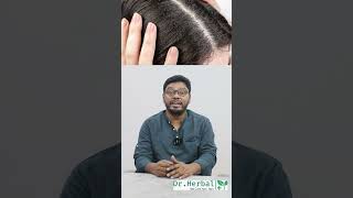 ❌தினமும் தலைக்கு SHAMPOO போடலாமா🚫💯Frequent Hair Wash\u0026Hair Loss▶️Daily Hair Mistakes You Should Avoid