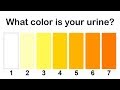 What The Color of Your Urine Says About Your Health