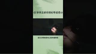 湖南42岁博主嚼槟榔10年后患口腔癌