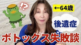 【ボトックス後遺症】ボトックスの場所が悪かったお話をします【ボトックス後悔】