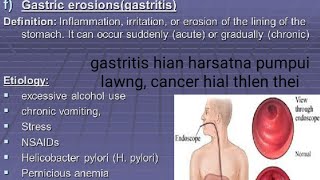 Gastritis( Pumpui sa hut Hut) Lo awm chhan leh in ven dan