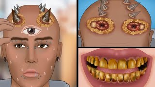 ASMR Causes and The best treatment yellow teeth clean up between teeth