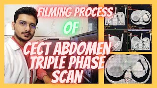 CT SCAN Abdomen Triple phase Filming process| Triphasic abdominal Filming #radiologytechnologist