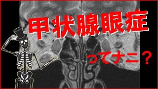 【甲状腺】甲状腺眼症の診断方法！治療に最も大切なことは？