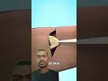 Growing An Ear In Your Arm ☺ #shorts #trending #viral