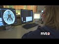 Kettering Health Network uses artificial intelligence to benefit stroke patients