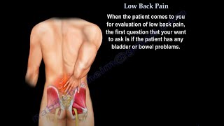 Low Back pain, causes, diagnosis, imaging and treatment