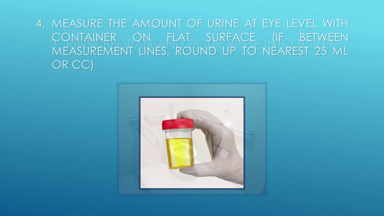 What Is Urine Output Measured In At Patricia Salinas Blog