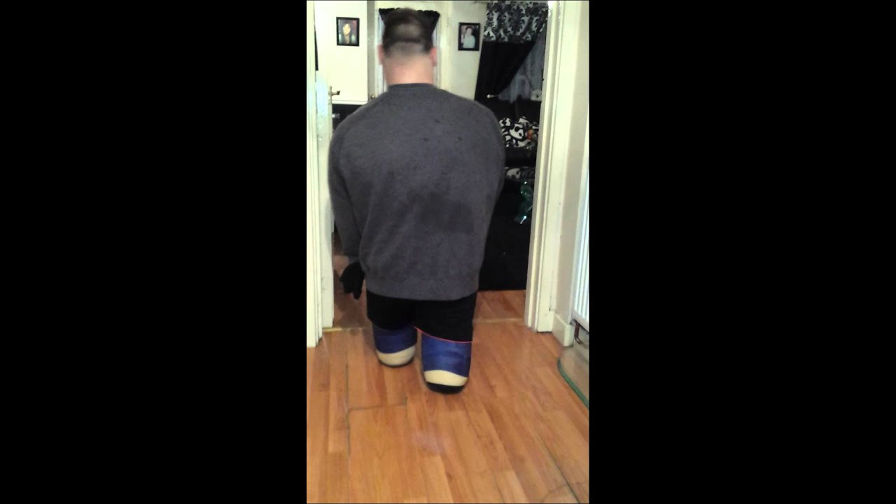 DAK Amputee Stubbies Controlled Walking - YouTube