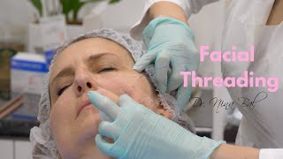 Facial Threads Lift Before and After | Thread Lift Face 💕 Dr. Nina Bal 💕 Facial
