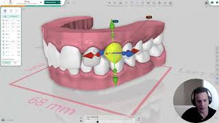 New Fully Automatic Segmentation in Titan Dental Design and A Glimpse into the Future