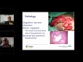 Surgery - Common neonatal conditions - Mr M Upadhyaya - 5Jan2021