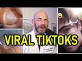 Dermatologist's Jaw-Dropping Reaction to Amazing Pimple Pops