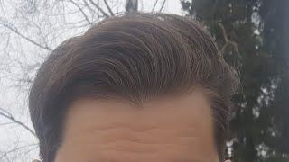 Can you take both Finasteride and Nutrafol for receding hairline?