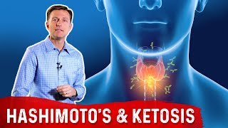 Hashimoto's Disease (Hypothyroid) and Keto (Ketogenic Diet) – Dr. Berg