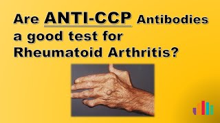 Are anti CCP Antibodies a Good Test for Rheumatoid Arthritis?