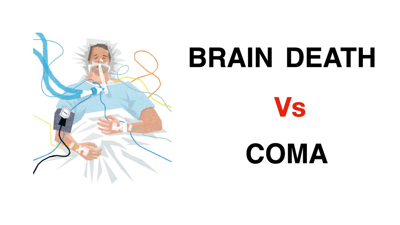 What Is Coma ? Vegetative State ? II Brain Death Vs Coma II Organ ...