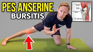 Pes Anserine Bursitis - Knee Rehab Exercises