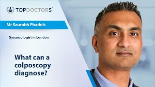 What can a colposcopy diagnose? - Online interview