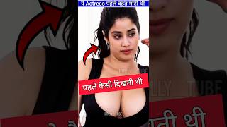 ये Actress पहले बहुत मोटी हुआ करती थी | ByBolly_tube