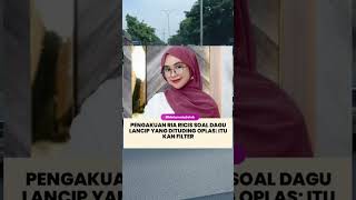 Ria Ricis tidak Melakukan Oplas cuma Pakai Filter