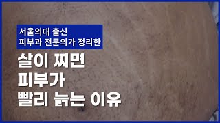 비만이라면 살을 빼셔야 하는 이유 1 (피부가 이렇게 망가집니다)