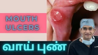 Mouth Ulcers | வாய் புண் காரணங்களும் தீர்வும் | Dr Arunkumar Pearls Dentistry Dental Clinic Chennai