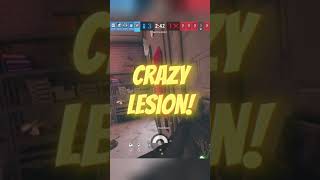 The CRAZY Lesion Does Not Miss! #rainbowsixsiege #xbox