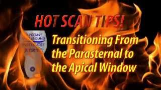 HOT TIP - Transitioning From the Parasternal to Apical Window