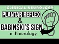 PLANTAR REFLEX | BABINSKI's SIGN | Equivocal Plantar | Other methods | Clinical Neurology