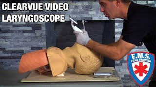 ClearVue Video Laryngoscope Overview