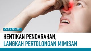 Penting! Ini Pertolongan Pertama Saat Mimisan | Cara Sehat