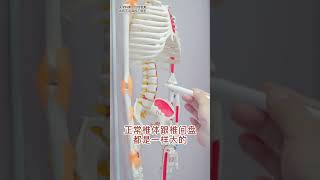 腰痛是怎么引起的？#腰痛  #中医