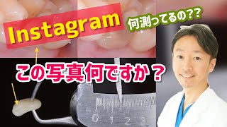 【インスタの写真一枚】で話します2「単純な支台歯形成のクリアランス確認」