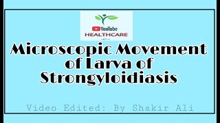 Strongyloidiasis Movement | Stool Routine Examination | by YouTube Healthcare