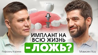 МИФЫ О ЗУБНЫХ ИМПЛАНТАХ: Это больно? Как избежать отторжения и что нужно знать пациенту? Усо Мамоян