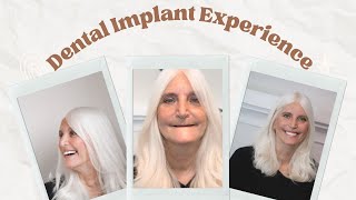 Dental Implant Before and After: My Life-Changing Dental Transformation