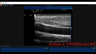Cardiovascular Suite - study report