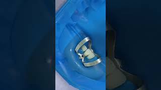 composite veneer installation process #shorts #dentist #dental #implant #veneers